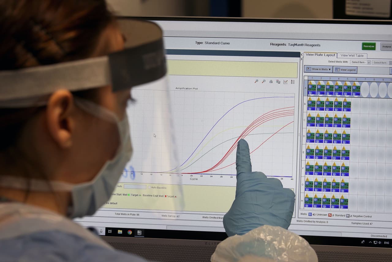 Debe haber una disminución sostenida de las enfermedades similares al coronavirus durante 14 días.
<b> </b>Actualmente, la tendencia de Carolina del Norte indica que este indicador está mejorando.