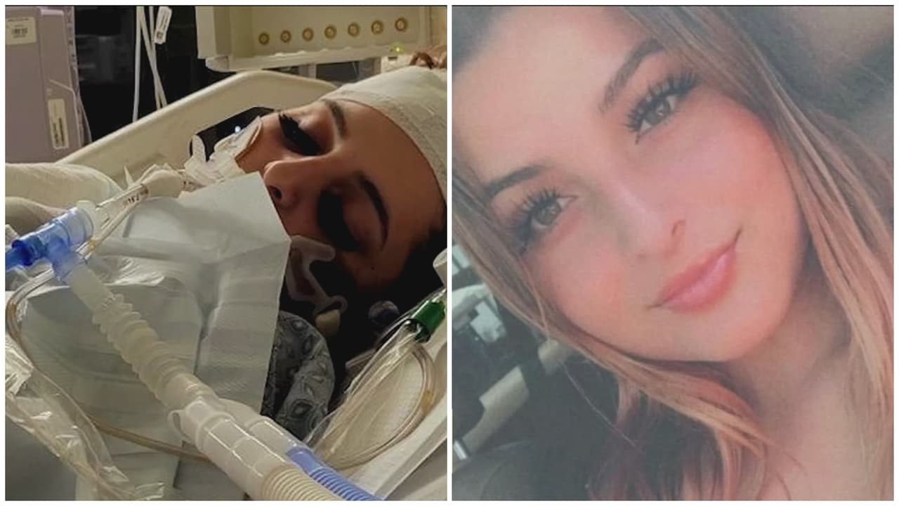 "Tiene su cerebrito ya muerto", dijo Manuela Sahagún, madre de la víctima. Los doctores del hospital Memorial de Long Beach indicaron que los daños a la salud de la joven son irreparables, según sus familiares.