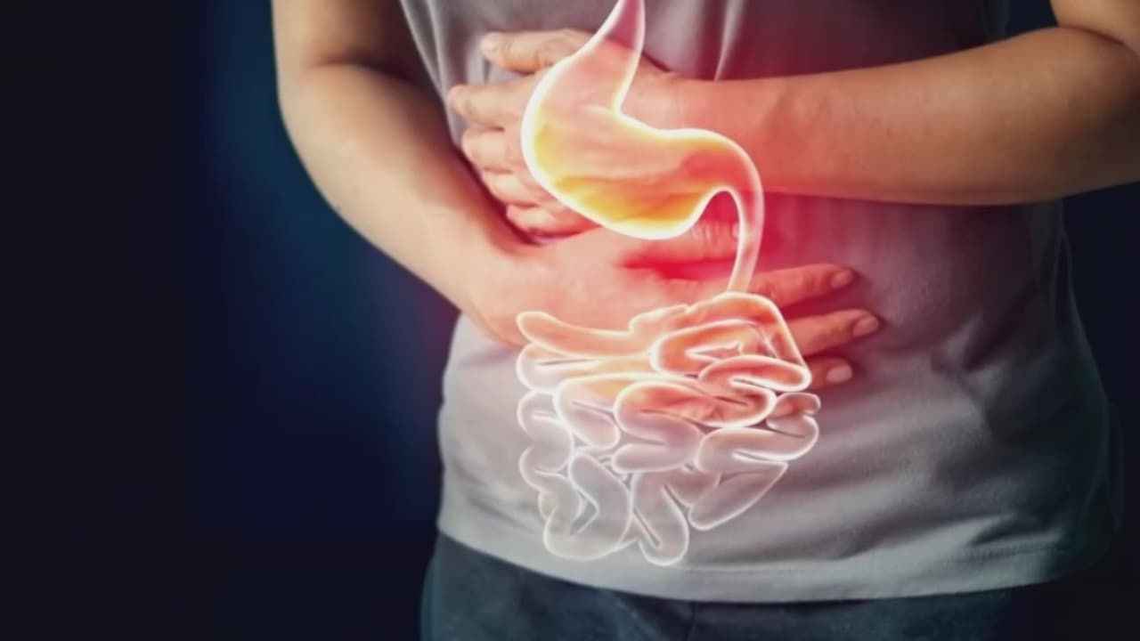 Casos de cáncer gastrointestinal aumentan en menores de 50 años: te contamos cómo prevenirlo