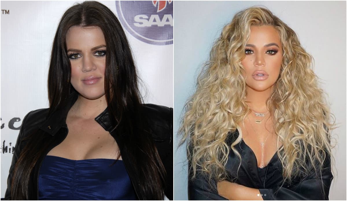 Pero aunque Khloe asegure no haber pasado aún por el bisturí, no descarta hacerlo en unos años: "No me he inyectado bótox ni nada de eso todavía, pero no me importaría hacerlo. En cuanto necesite relleno, porque algún día lo necesitaré, me inyectaré. Pero hasta entonces haré lo que pueda para prevenir las arrugas y el envejecimiento", confesó.