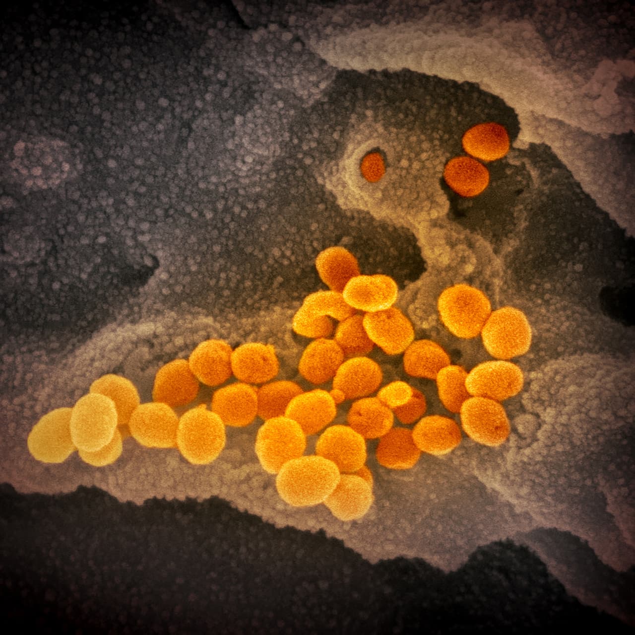"Eso no es sorprendente: los picos en la superficie de los coronavirus le dan a esta familia de virus su nombre: corona, y la mayoría de los coronavirus tendrán una apariencia similar a la corona", explica el instituto.