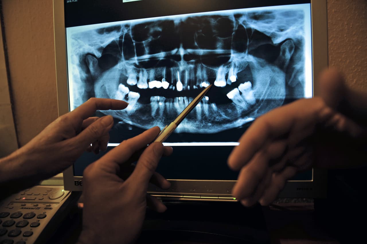 <b>Puesto 9. Cirujano/a maxilofacial. </b>Salario promedio: 208,000 dólares. Tasa de desempleo: 0.4%. Son dentistas con especialización en cirugía que puedan realizar operaciones en la boca, los dientes, el cuello y la cabeza. Estos profesionales de la salud pueden reparar el paladar hendido, extirpar un tumor o reparar un trauma facial. Esta ocupación aumentará un 7% para 2028, según el BLS.