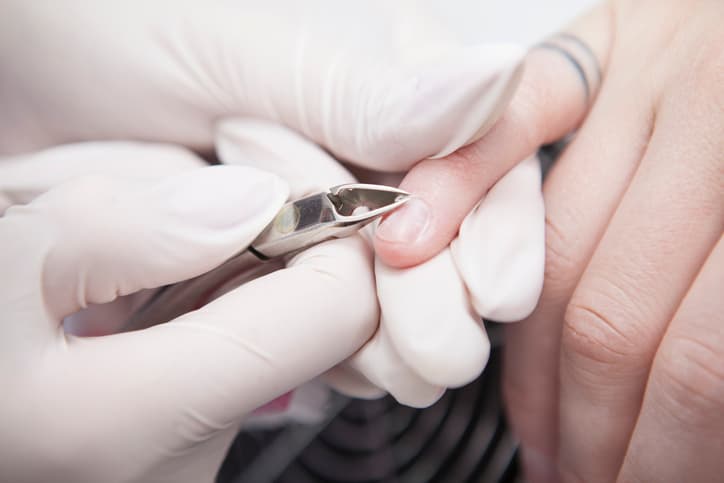 Sufrió una cortada durante una manicura. Meses después le diagnosticaron un cáncer por VPH en la uña