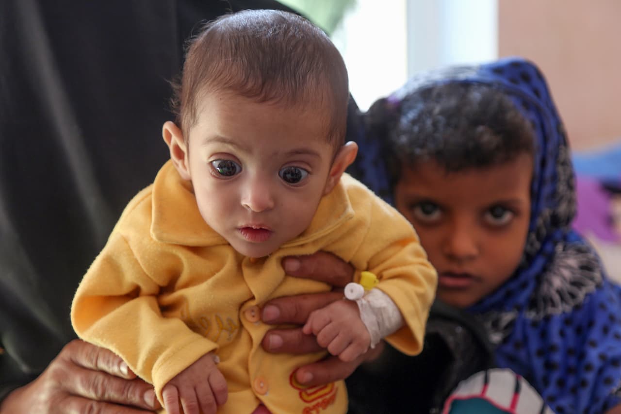 Cerca de 14 millones de personas corren el riesgo de sufrir una hambruna. Según Save the Children, "esta cifra ha aumentado drásticamente desde que la coalición liderada por Arabia Saudí y Emiratos Árabes Unidos 
<i>—</i>quienes apoyan al presidente Abd Rabbu Mansour Hadi contra los rebeldes
<i>—</i> impuso un bloqueo a Yemen hace poco más de un año".