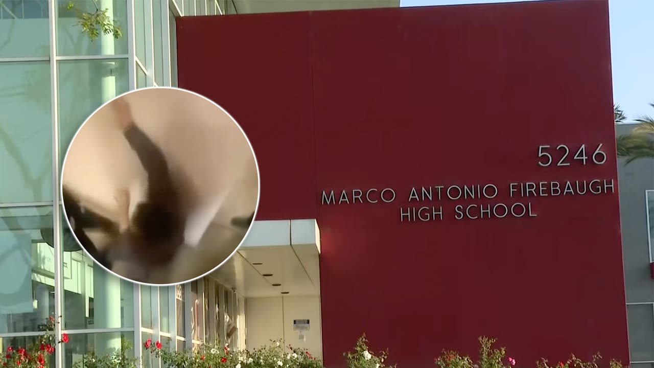 Padre hispano denuncia golpiza a su hijo en escuela de Lynwood y encubrimiento por parte del director