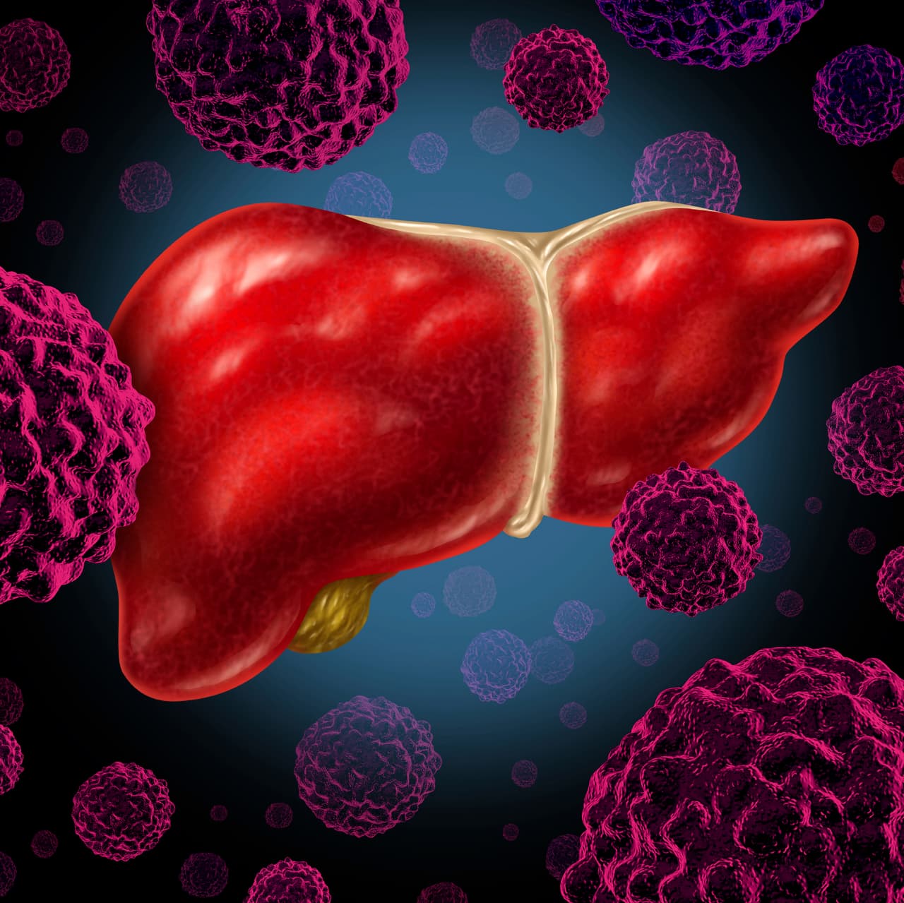 Aumenta el número de muertes por cáncer de hígado en EEUU
