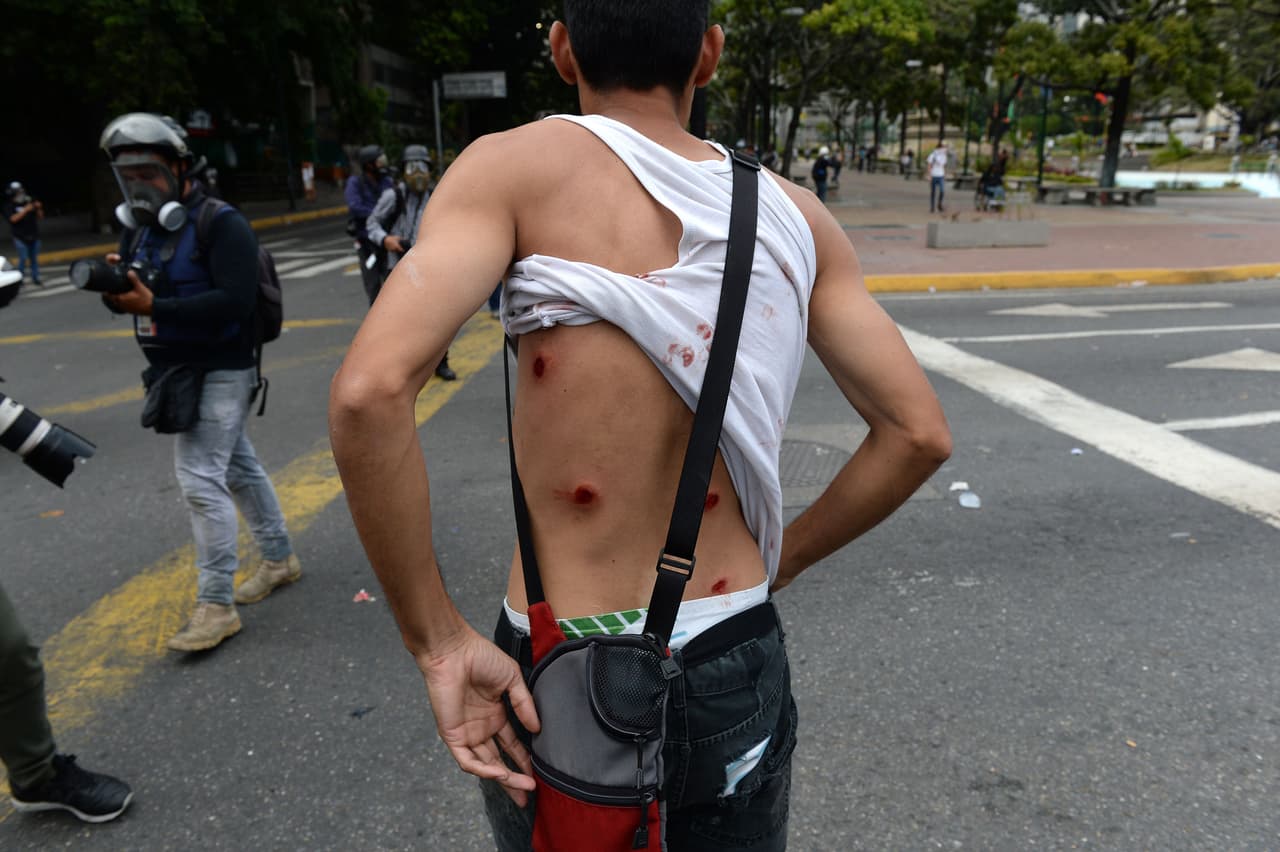 Las imágenes han mostrado que algunos manifestantes están siendo atendidos por paramédicos. La manifestación de la oposición coincidió con la celebración de los 61 años de la caída de la dictadura militar y fue la primera movilización multitudinaria, tras la ola de intensas protestas antigubernamentales que en 2017 dejaron cientos de muertos y heridos.