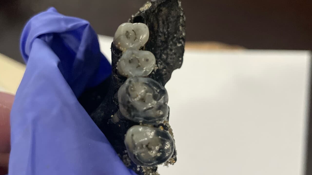 Después de un examen inicial, el patólogo solicitó fotos adicionales enfocadas en los cuatro dientes.
<br>