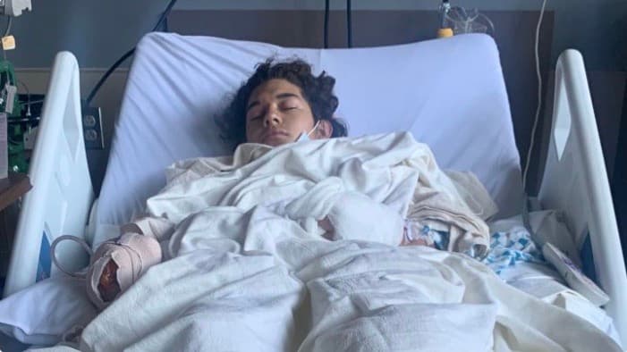 Adolescente pierde una de sus manos manipulando fuegos artificiales en Delano