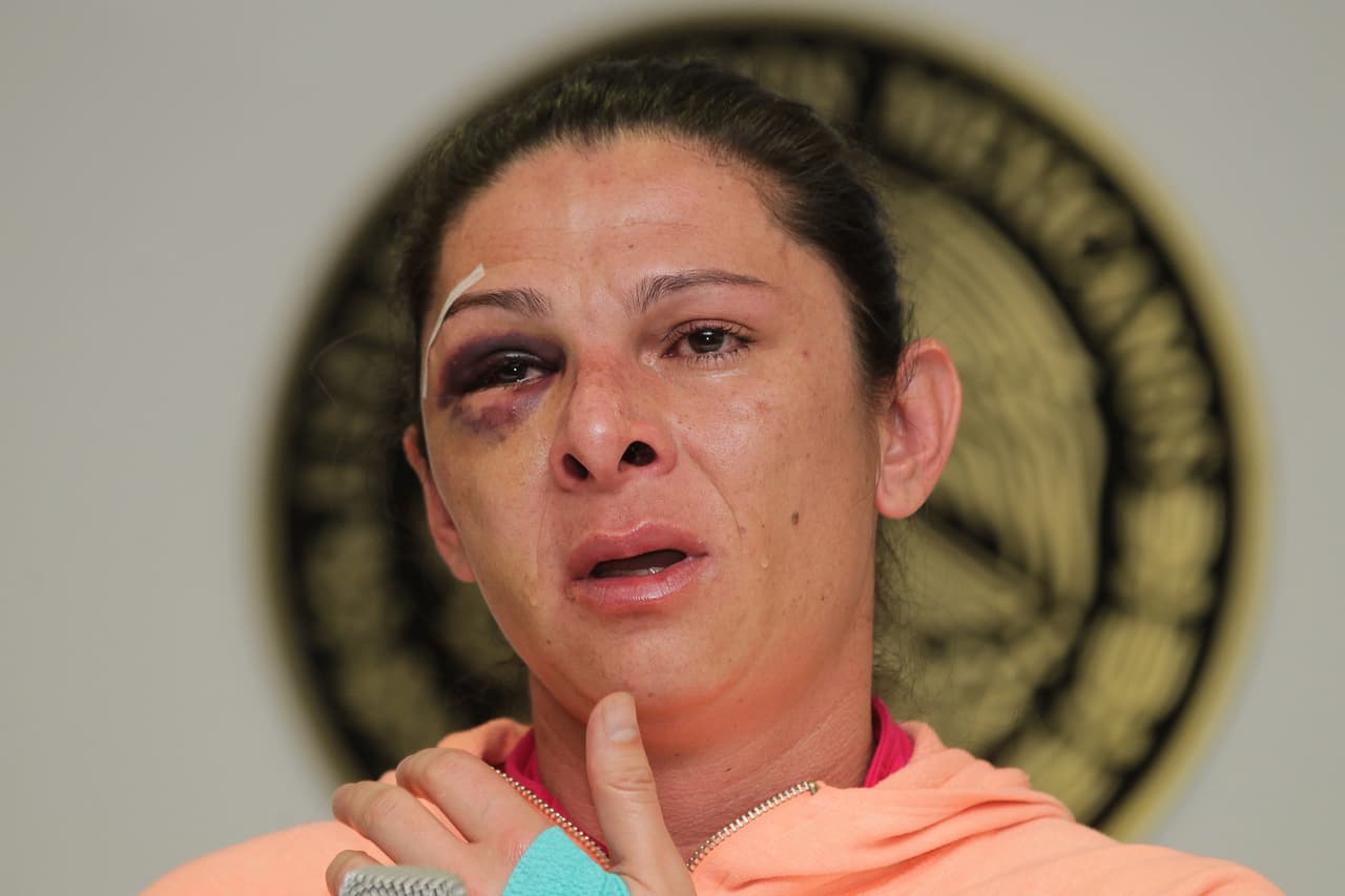 Ana Gabriela Guevara, una de las principales figuras del deporte y senadora mexicana conducía su motocicleta por una carretera cuando fue embestida por un vehículo. 
<a href="https://www.univision.com/noticias/sucesos/cuatro-hombres-atropellan-golpean-e-insultan-a-una-senadora-mexicana"><b>Cuando quiso reclamar, recibió una paliza de cuatro hombres. Tuvo que ser hospitalizada.</b></a> A unas horas de haber sido golpeada, la exvelocista dijo que la agresión es solo una entre las que a diario viven las mujeres en México y aseguró sentirse preocupada porque la situación de violencia de género es generalizada, agravada por el hecho de que muchos agresores se quedan impunes.
<br>
