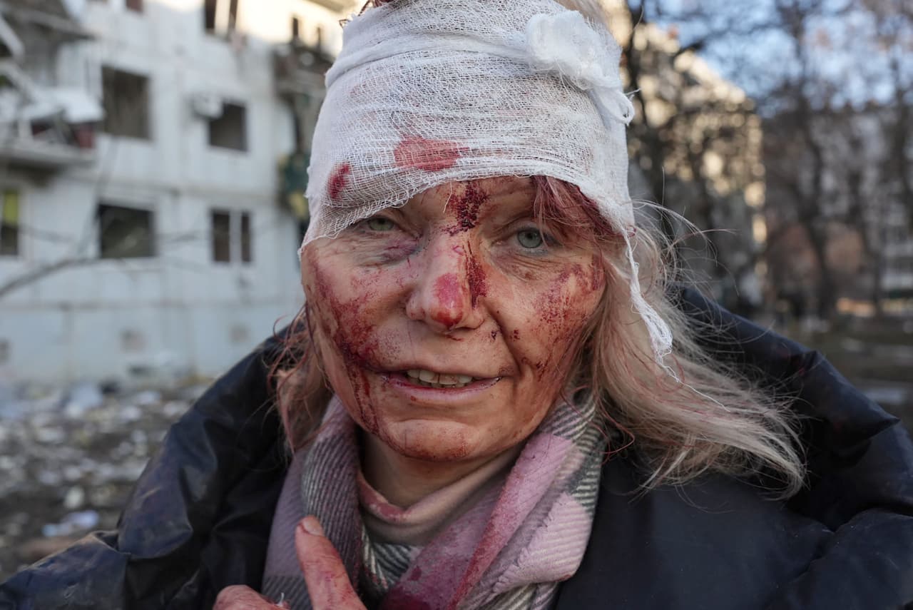 Olena Kurilo es una maestra de 52 años que resultó herida en un ataque aéreo ruso a un complejo de apartamentos en Kharkiv, al este de Ucrania, el 24 de febrero. 
<br>
<br>El Servicio de Emergencias de Ucrania indicó que más de 2,000 civiles han muerto desde que empezó el conflicto y la oficina de derechos humanos de Naciones Unidas ha registrado 136 muertes de civiles, pero advirtió que la cifra total sería mucho mayor.
<br>
<br>
<a href="https://www.univision.com/noticias/mundo/horror-conflicto-rusia-ucrania-invasion-siete-dias-fotos"><u>Vea aquí las fotos del horror de la guerra en Ucrania a una semana de la invasión rusa</u></a>
<br>