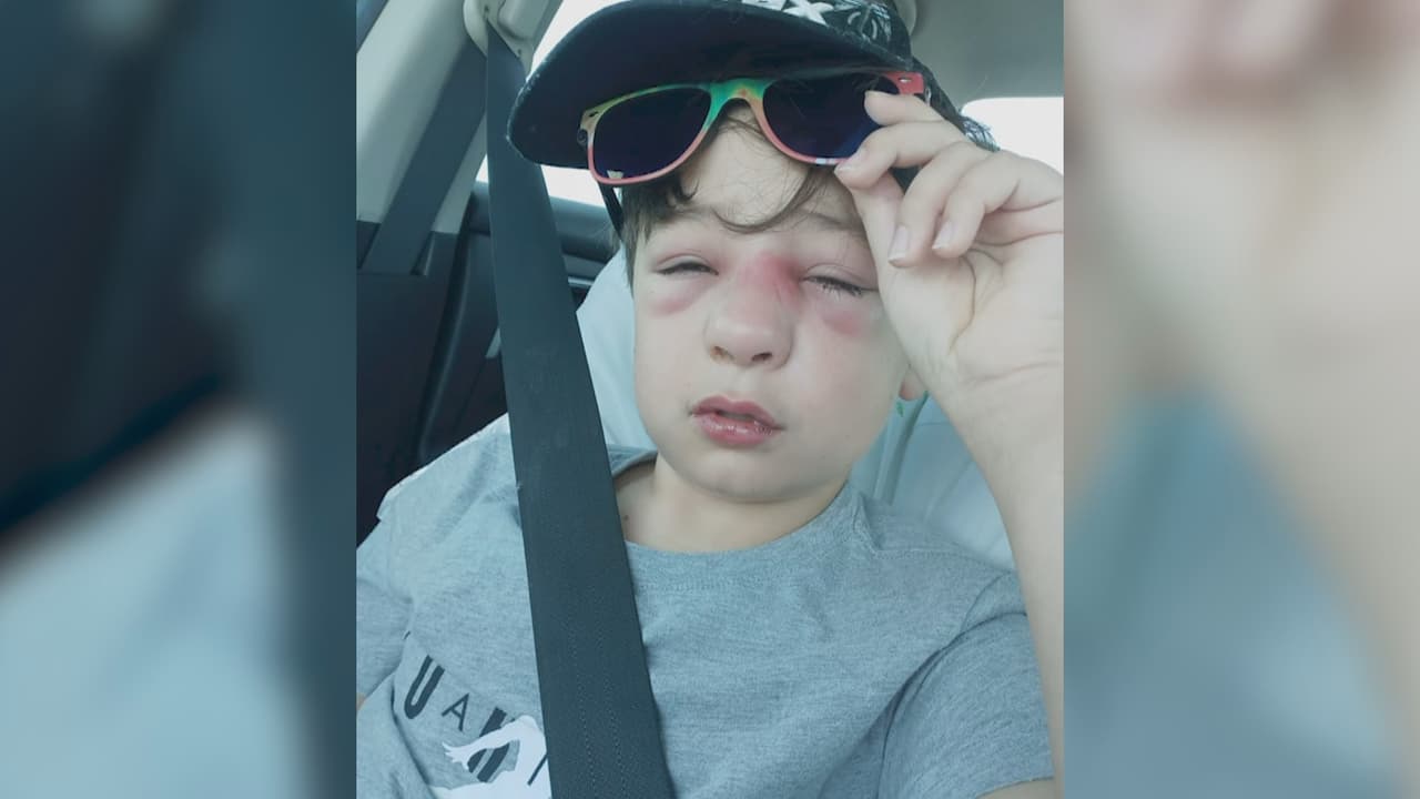 "Me sentía terrible de ver a mi hijo sufrir": niño lucha contra una infección grave después de dar positivo al coronavirus