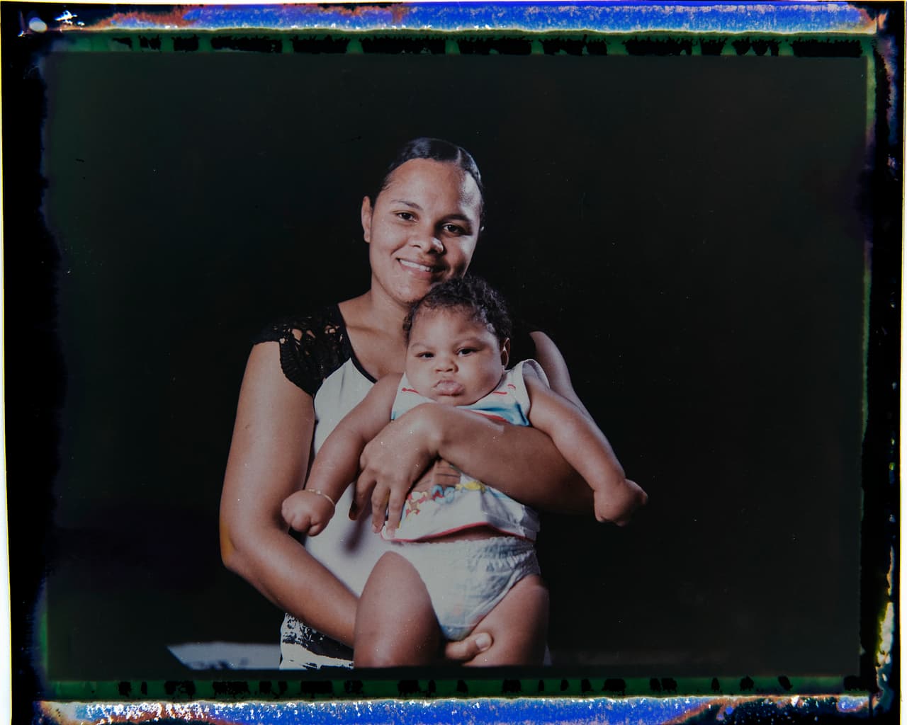 A diferencia de otras madres con hijos que padecen microcefalia, Vanessa dos Santos vive cerca de un centro de rehabilitación. Su hijo, Enzo, come mejor que antes y ha ganado peso, pero aún así necesita tomar sus medicamentos dos veces al día. Estos medicamentos le ayudan a controlar las convulsiones y a facilitar sus movimientos, ya que tiene dificultades para mover varias partes de su cuerpo, especialmente sus manos.