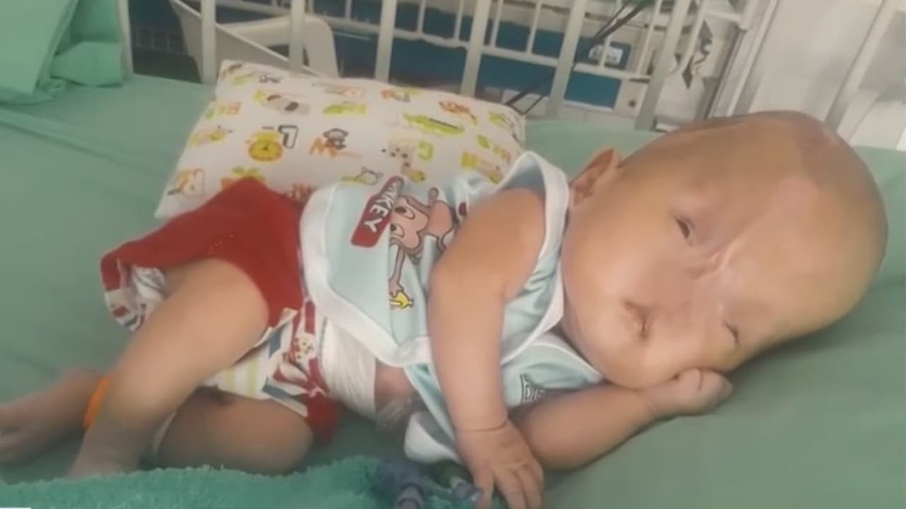Su madre consiguió un médico que quiere donarle una operación para mejorar su calidad de vida, pero la mujer no tiene dinero para costear medicamentos, postoperatorio y la terapia que necesitaría después.