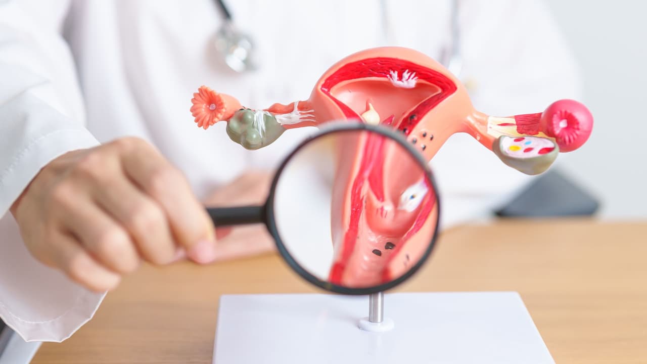 Cáncer cervical: señales a las que toda mujer debe estar muy atenta