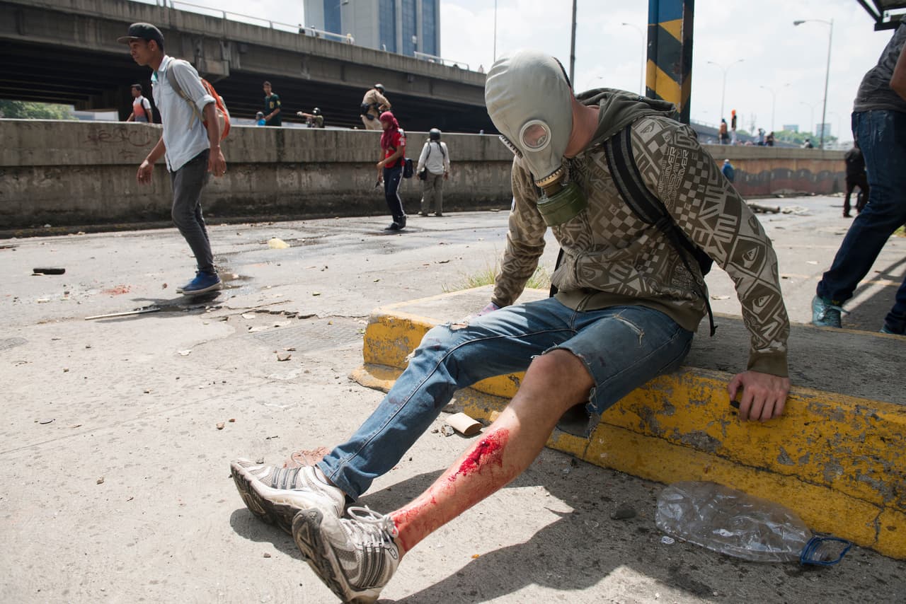 Un manifestante de oposición herido, en una acera de Caracas. 6 de abril de 2017.