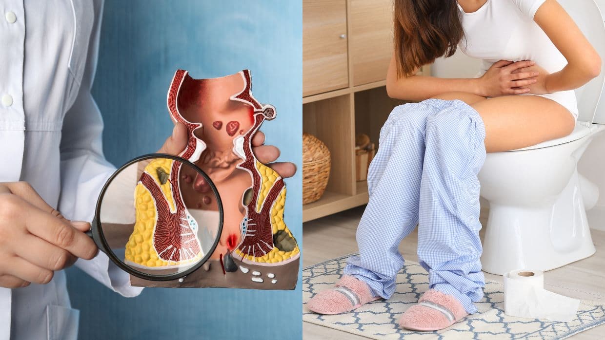 ¿Te estriñes constantemente? Estos son los días que puedes estar sin ir al baño 