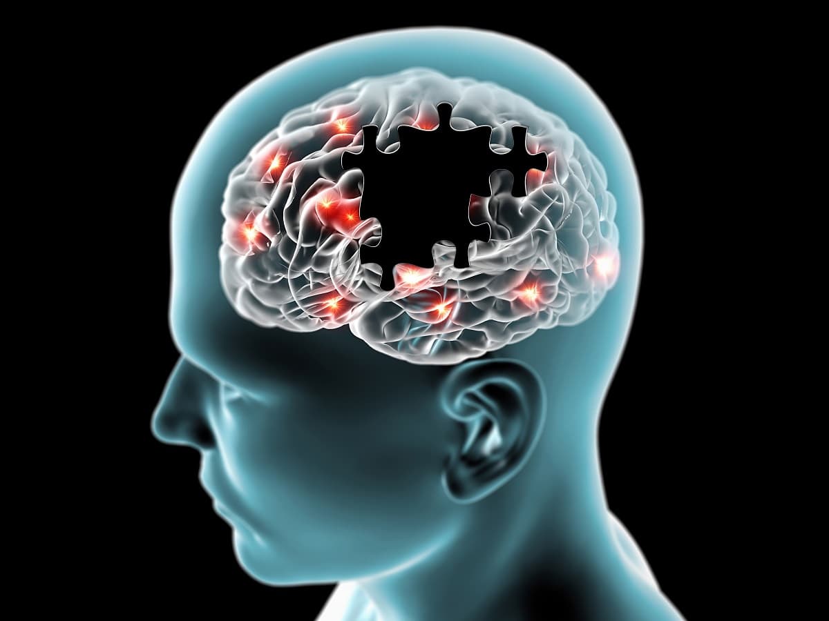 La cura del Alzheimer podría estar en los genes de una longeva mujer colombiana