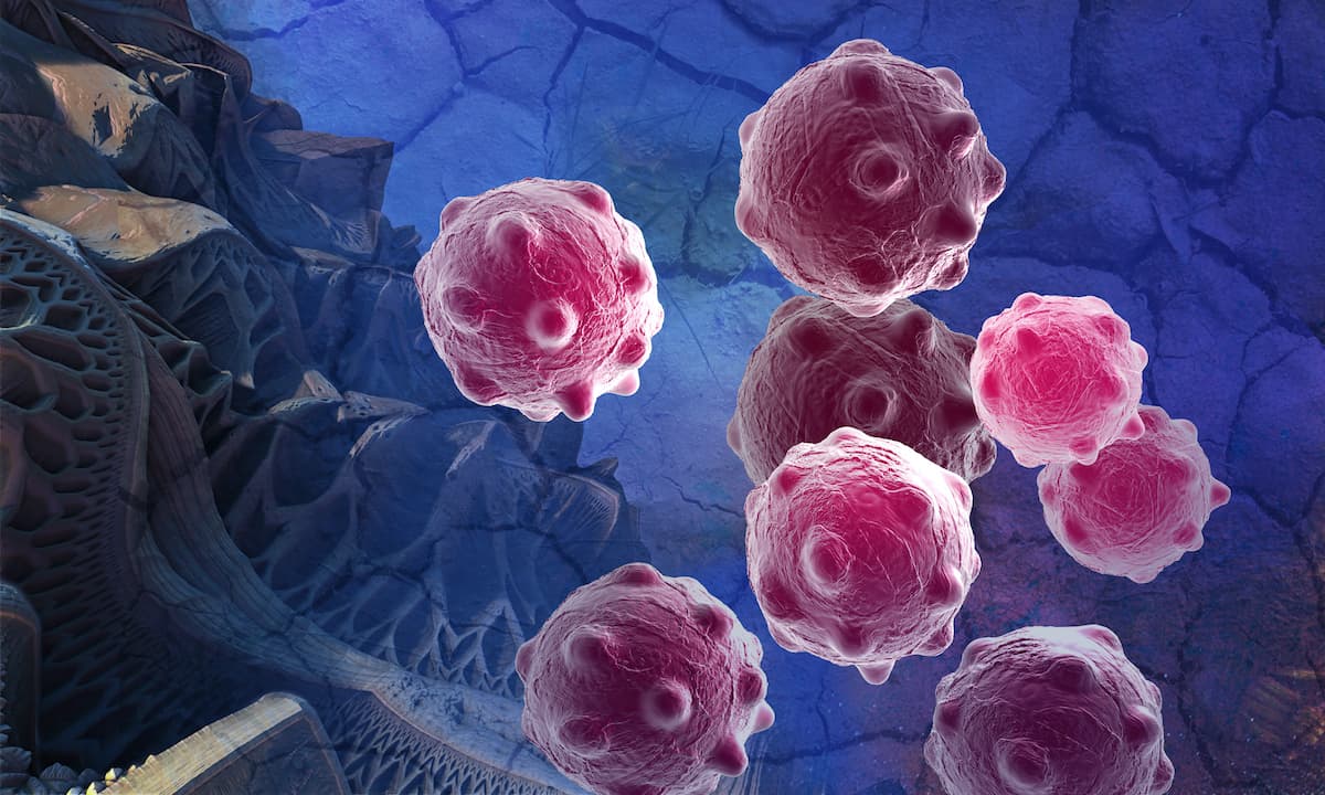 Cepillín murió de cáncer linfático, ¿cuáles son los síntomas de esta enfermedad?