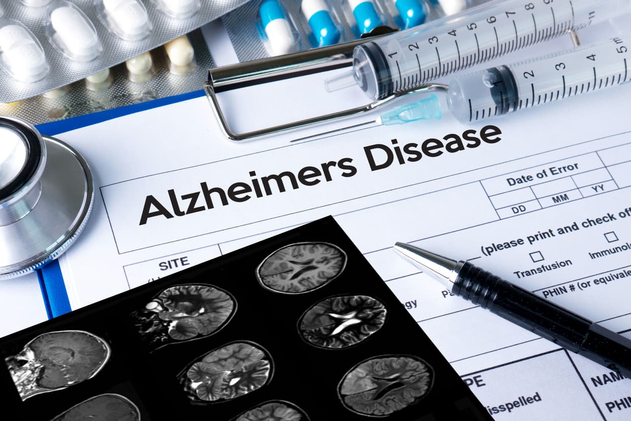 El Alzheimer se podrá detectar antes de los primeros síntomas gracias a una prueba casera