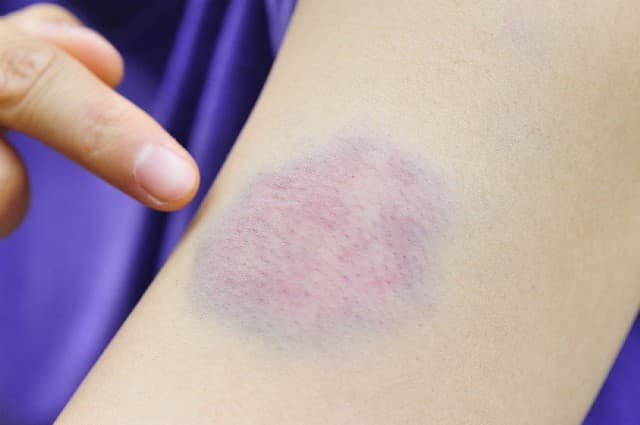 ¿Tu hijo se corta la piel? Esto es lo que está tratando de decir
