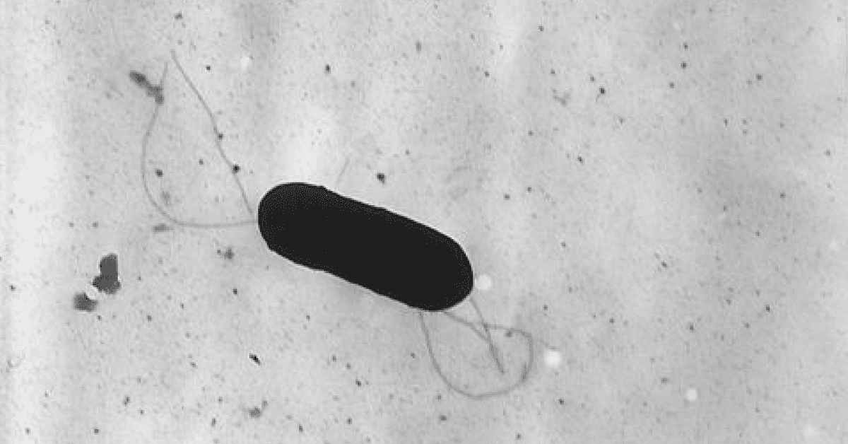 Alertan por pasta congelada con un posible brote de listeria en NY