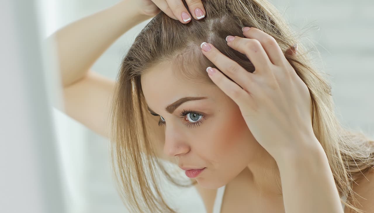 La caída de cabello puede deberse a una enfermedad intestinal que muchos tienen sin saberlo
