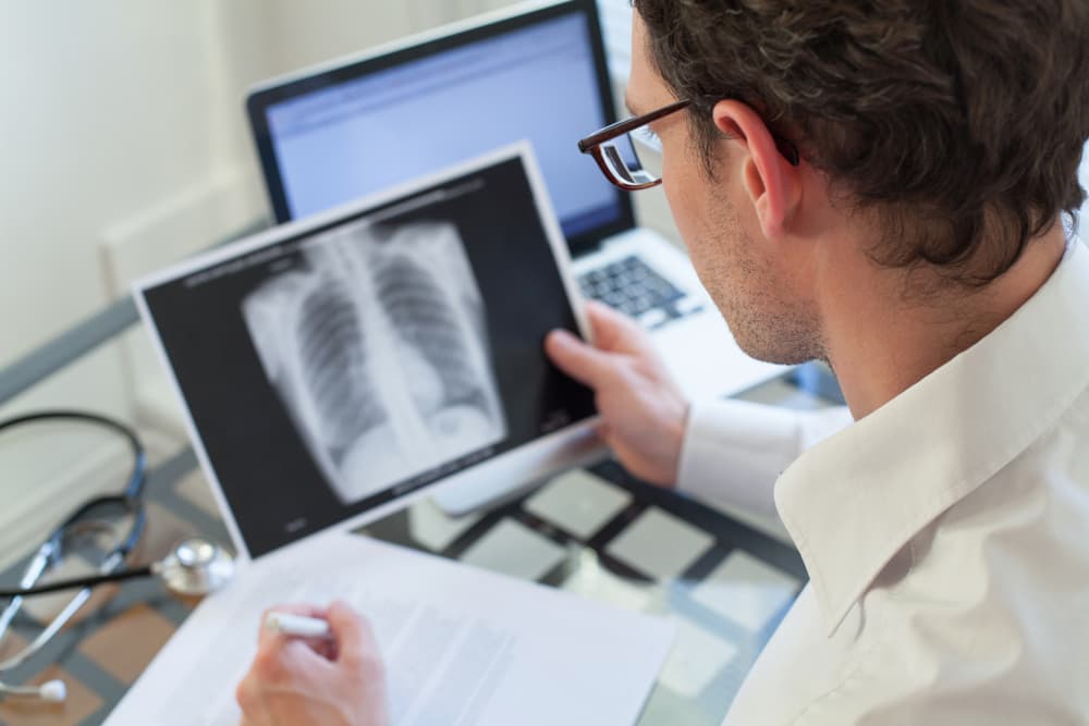7 causas del cáncer de pulmón QUE NO SON FUMAR y seguro no conocías