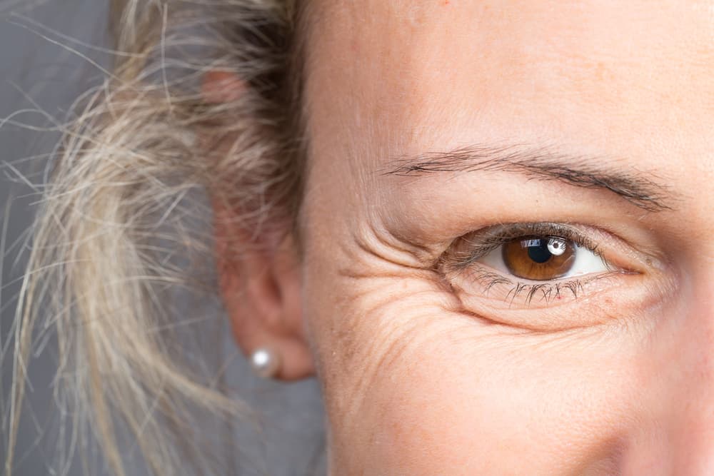 Las arrugas dicen mucho sobre tu salud y son más que una cuestión de belleza